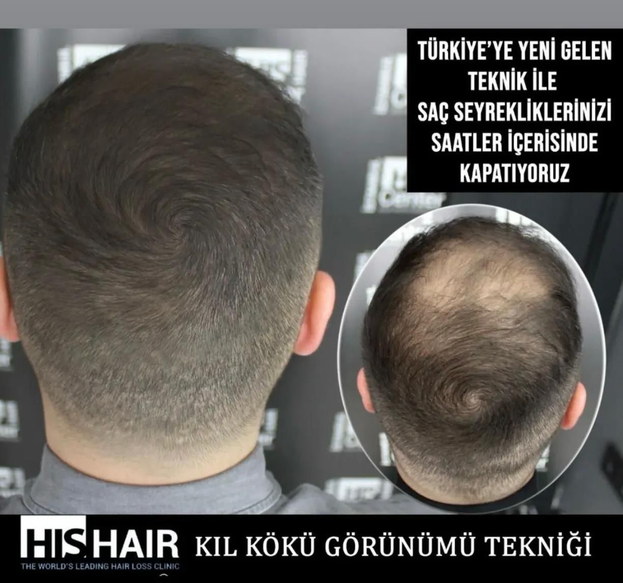 SMP Sonuç 2